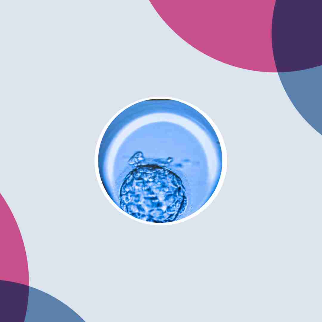 Image of a blastocyst
