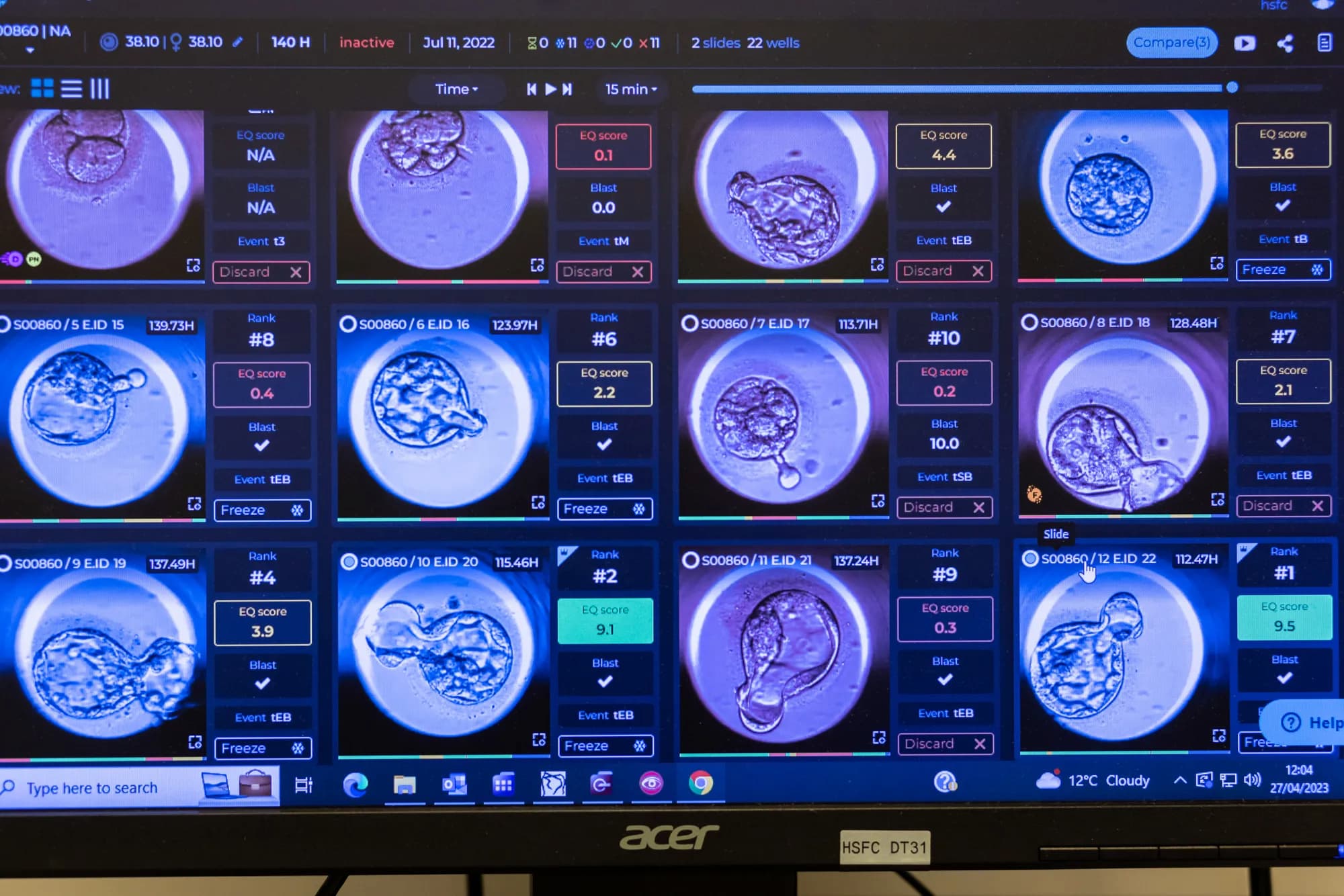 Blastocyst at different developmental stages