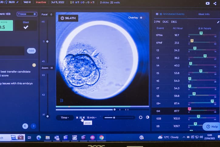 Day 4 blastocyst-1