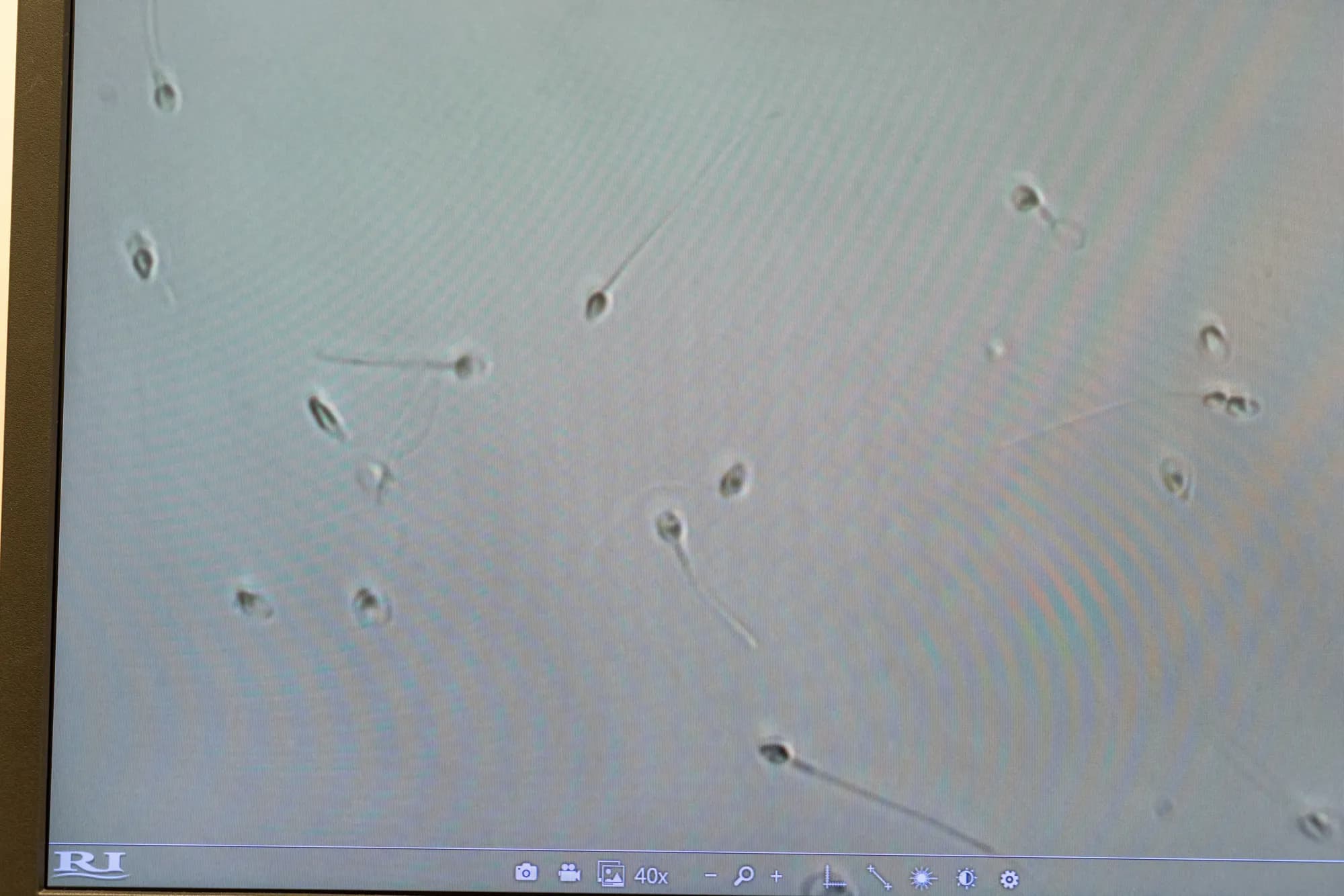 Sperm moving