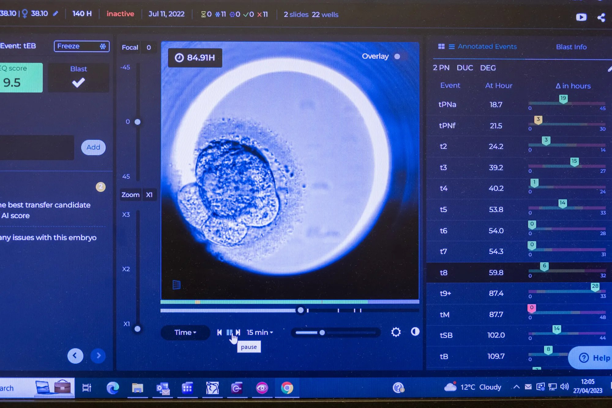 Blastocyst developing as seen on a screen 