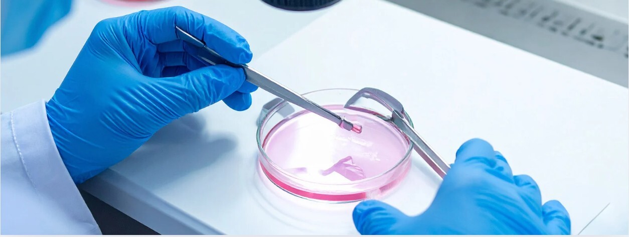 IVF-Acronyms-Explained